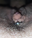 My swollen clit