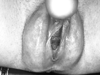 Puffy Pregnant Amateur Pussy